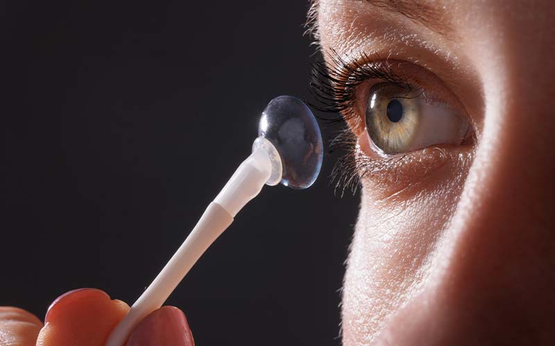 orthokeratologie